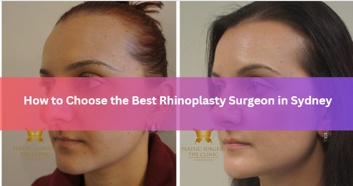 How to Choose the Best Rhinoplasty Surgeon in Sydney
